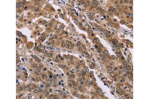 Immunohistochemistry (IHC) image for anti-Family with Sequence Similarity 3, Member B (FAM3B) antibody (ABIN2423425) (FAM3B Antikörper)