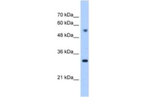 Western Blotting (WB) image for anti-Tetratricopeptide Repeat Domain 5 (TTC5) antibody (ABIN2463249) (TTC5 Antikörper)