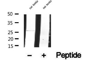 Western blot analysis of extracts of rat testis tissue, using DCTN6 antibody. (DCTN6 Antikörper  (Internal Region))