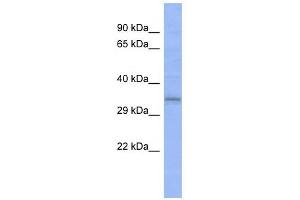 C20ORF111 antibody used at 1 ug/ml to detect target protein. (C20orf111 Antikörper  (N-Term))