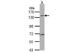 WB Image Sample(30 ug whole cell lysate) A:Raji , 7. (CD22 Antikörper)