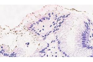 Immunohistochemical staining for Helicobacter pylori: clone ULC3R (Helicobacter Pylori Antikörper)