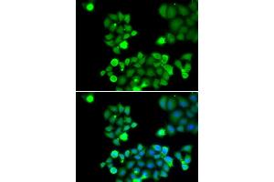 Immunofluorescence analysis of HeLa cell using NEIL1 antibody. (NEIL1 Antikörper)