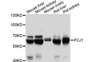 Western blot analysis of extracts of various cell lines, using PCK1 antibody (ABIN5971068) at 1/1000 dilution. (PCK1 Antikörper)