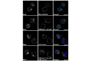 Immunostaining (ISt) image for anti-Perilipin 2 (PLIN2) (AA 1-29), (N-Term) antibody (ABIN285650)