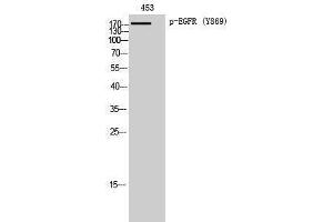 Western Blotting (WB) image for anti-Epidermal Growth Factor Receptor (EGFR) (pTyr869) antibody (ABIN3181991) (EGFR Antikörper  (pTyr869))