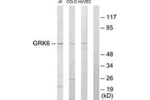 Western Blotting (WB) image for anti-G Protein-Coupled Receptor Kinase 6 (GRK6) (AA 10-59) antibody (ABIN2889479) (GRK6 Antikörper  (AA 10-59))