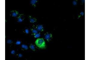 Immunofluorescence (IF) image for anti-alpha-Fetoprotein (AFP) antibody (ABIN1496486) (alpha Fetoprotein Antikörper)