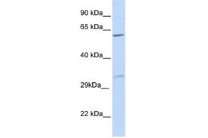 PRPS2 antibody used at 1 ug/ml to detect target protein. (PRPS2 Antikörper  (N-Term))