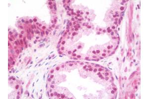 Anti-TRIM33 / TIF1-Gamma antibody IHC staining of human prostate. (TRIM33 Antikörper  (Internal Region))