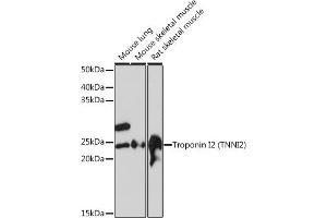 Western blot analysis of extracts of various cell lines, using Troponin I2 (Troponin I2 (TNNI2)) Rabbit mAb (ABIN1679777, ABIN7101727, ABIN7101728 and ABIN7101729) at 1:1000 dilution. (TNNI2 Antikörper)