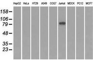 Western blot analysis of extracts (35 µg) from 9 different cell lines by using anti-SATB1 monoclonal antibody. (SATB1 Antikörper)