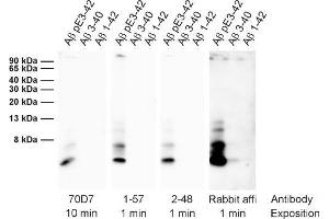 Detection of different synthetic Abeta species (dilution 1 : 1000). (Abeta-pE3 Antikörper)