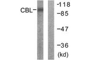 Western Blotting (WB) image for anti-Cas-Br-M (Murine) Ecotropic Retroviral Transforming Sequence (CBL) (AA 666-715) antibody (ABIN2888651) (CBL Antikörper  (AA 666-715))
