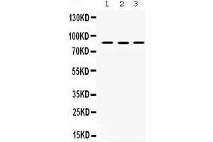 Western Blotting (WB) image for anti-MutL Homolog 1 (MLH1) (AA 722-756), (C-Term) antibody (ABIN3043404) (MLH1 Antikörper  (C-Term))