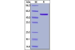 Biotinylated Human ROR2, His,Avitag on  under reducing (R) condition. (ROR2 Protein (AA 34-403) (His tag,AVI tag,Biotin))