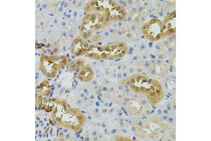 Immunohistochemistry of paraffin-embedded rat kidney using NAT8 antibody. (NAT8 Antikörper)