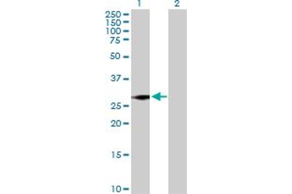 SNRPN Antikörper  (AA 1-240)