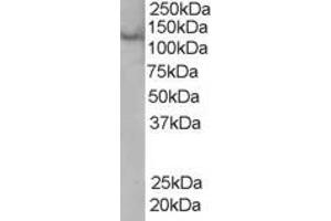 Western Blotting (WB) image for anti-Zinc Finger, FYVE Domain Containing 20 (ZFYVE20) (C-Term) antibody (ABIN2466174) (Rabenosyn 5 Antikörper  (C-Term))