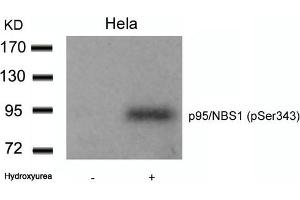 Western blot analysis of extracts from Hela cells untreated or treated with Hydroxyurea using p95/NBS1(Phospho-Ser343) Antibody. (Nibrin Antikörper  (pSer343))