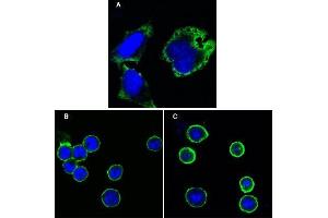 Confocal immunofluorescence analysis of Hela cells (A), BCBL-1 cells (B) and L1210 cells (C) using MPS1 antibody (green). (Mps1 Antikörper)