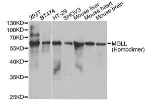 Western blot analysis of extracts of various cell lines, using MGLL antibody. (MGLL Antikörper)