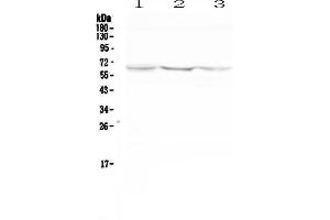 Western blot analysis of NOX2 using anti-NOX2 antibody . (CYBB Antikörper  (AA 416-500))