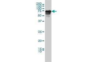 Western Blotting (WB) image for anti-Calcium/calmodulin-Dependent Protein Kinase Kinase 2, beta (CAMKK2) (AA 1-130) antibody (ABIN564643)