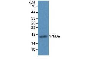 Detection of Recombinant ALOX15, Human using Monoclonal Antibody to Arachidonate-15-Lipoxygenase (ALOX15) (ALOX15 Antikörper  (AA 170-312))
