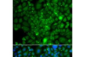 Immunofluorescence analysis of A549 cells using RRAGA Polyclonal Antibody (RRAGA Antikörper)