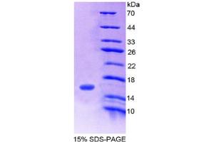 SDS-PAGE analysis of Human FAM132A Protein. (FAM132A Protein)