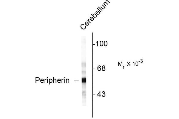 Peripherin Antikörper