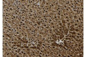 ABIN6277063 at 1/100 staining Mouse liver tissue by IHC-P. (FGFR1 Antikörper  (C-Term))