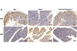 Immunohistochemistry (IHC) image for anti-B-Cell CLL/lymphoma 2 (BCL2) (N-Term) antibody (ABIN2857047)