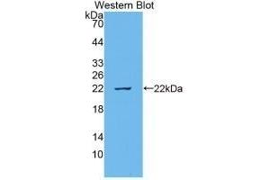 Detection of Recombinant IL18, Bovine using Monoclonal Antibody to Interleukin 18 (IL18) (IL-18 Antikörper  (AA 37-193))