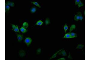 Immunofluorescence staining of MCF-7 cells with ABIN7175590 at 1:100, counter-stained with DAPI. (CACNA1D Antikörper  (AA 1691-1806))