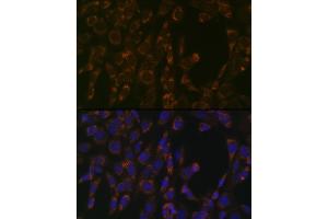 Immunofluorescence analysis of NIH-3T3 cells using CLPP Rabbit mAb (ABIN1682296, ABIN3017596, ABIN3017597 and ABIN7101508) at dilution of 1:100 (40x lens). (CLPP Antikörper)