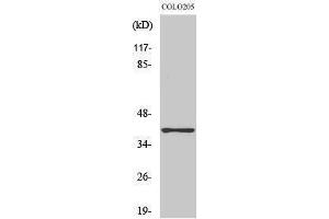 Western Blotting (WB) image for anti-Aldo-Keto Reductase Family 1, Member A1 (Aldehyde Reductase) (AKR1A1) (C-Term) antibody (ABIN3173732) (AKR1A1 Antikörper  (C-Term))