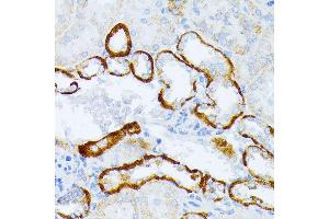 Immunohistochemistry of paraffin-embedded mouse kidney using IL3RA antibody (ABIN1680453, ABIN3018298, ABIN3018299, ABIN5664529 and ABIN6220429) at dilution of 1:100 (40x lens). (IL3RA Antikörper  (AA 1-100))