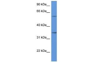 Western Blot showing CD34 antibody used at a concentration of 1 ug/ml against Hela Cell Lysate (CD34 Antikörper  (C-Term))