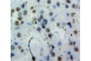 Used in DAB staining on fromalin fixed paraffin-embedded Kidney tissue (Cyclin D1 Antikörper  (AA 31-295))