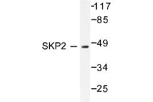 Image no. 1 for anti-S-Phase Kinase-Associated Protein 2 (SKP2) antibody (ABIN271816) (SKP2 Antikörper)