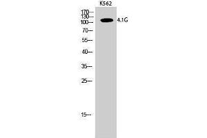 Western Blotting (WB) image for anti-erythrocyte Membrane Protein Band 4.1-Like 2 (EPB41L2) (Internal Region) antibody (ABIN6284384) (EPB41L2 Antikörper  (Internal Region))