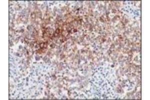 Immunohistochemistry (IHC) image for anti-Placental Alkaline Phosphatase (ALPP) antibody (ABIN870414) (PLAP Antikörper)