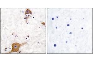 Immunohistochemistry analysis of paraffin-embedded human brain tissue, using NRG1 isoform-10 Antibody. (NRG1 Isoform-10 (AA 1-50) Antikörper)