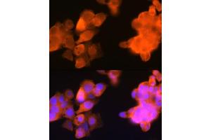 Immunofluorescence analysis of Hep G2 cells using C3 Rabbit mAb (ABIN1680027, ABIN3018233, ABIN3018234 and ABIN7101584) at dilution of 1:100 (40x lens). (AKR1C3 Antikörper)