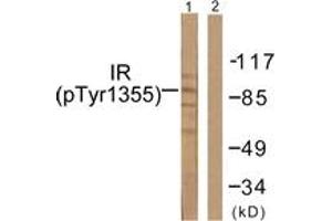 Western blot analysis of extracts from 293 cells treated with Heat shock, using IR (Phospho-Tyr1355) Antibody. (IR (AA 1326-1375), (pTyr1355) Antikörper)