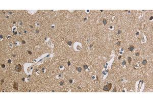 Immunohistochemistry of paraffin-embedded Human brain using CYCS Polyclonal Antibody at dilution of 1:50 (Cytochrome C Antikörper)