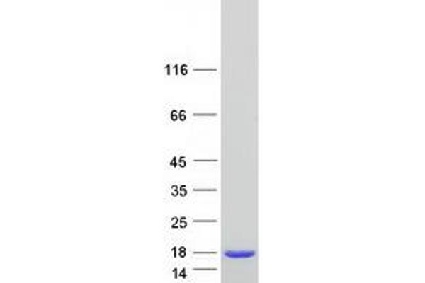 DYNLRB2 Protein (Myc-DYKDDDDK Tag)