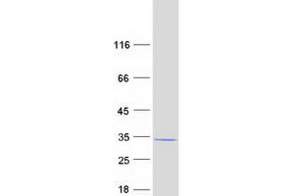 MTIF3 Protein (Myc-DYKDDDDK Tag)